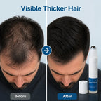 FollicleForce™ — Ignite Bold, Thick Hair That Commands Attention
