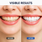 SmileLustre™ Whitening Serum — Reveal a Brilliant Smile That Lights Up Every Room