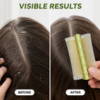 Calmora™— End Itch & Tangles for Smooth, Happy Scalp Freedom