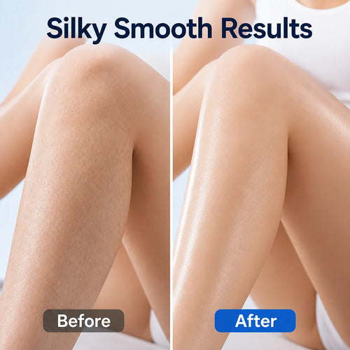 ChillLisse™ — Experience Pain-Free, Ice-Cool Smoothness That Lasts for Days